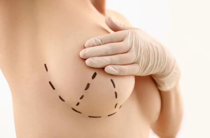 Breast augmentation and reduction